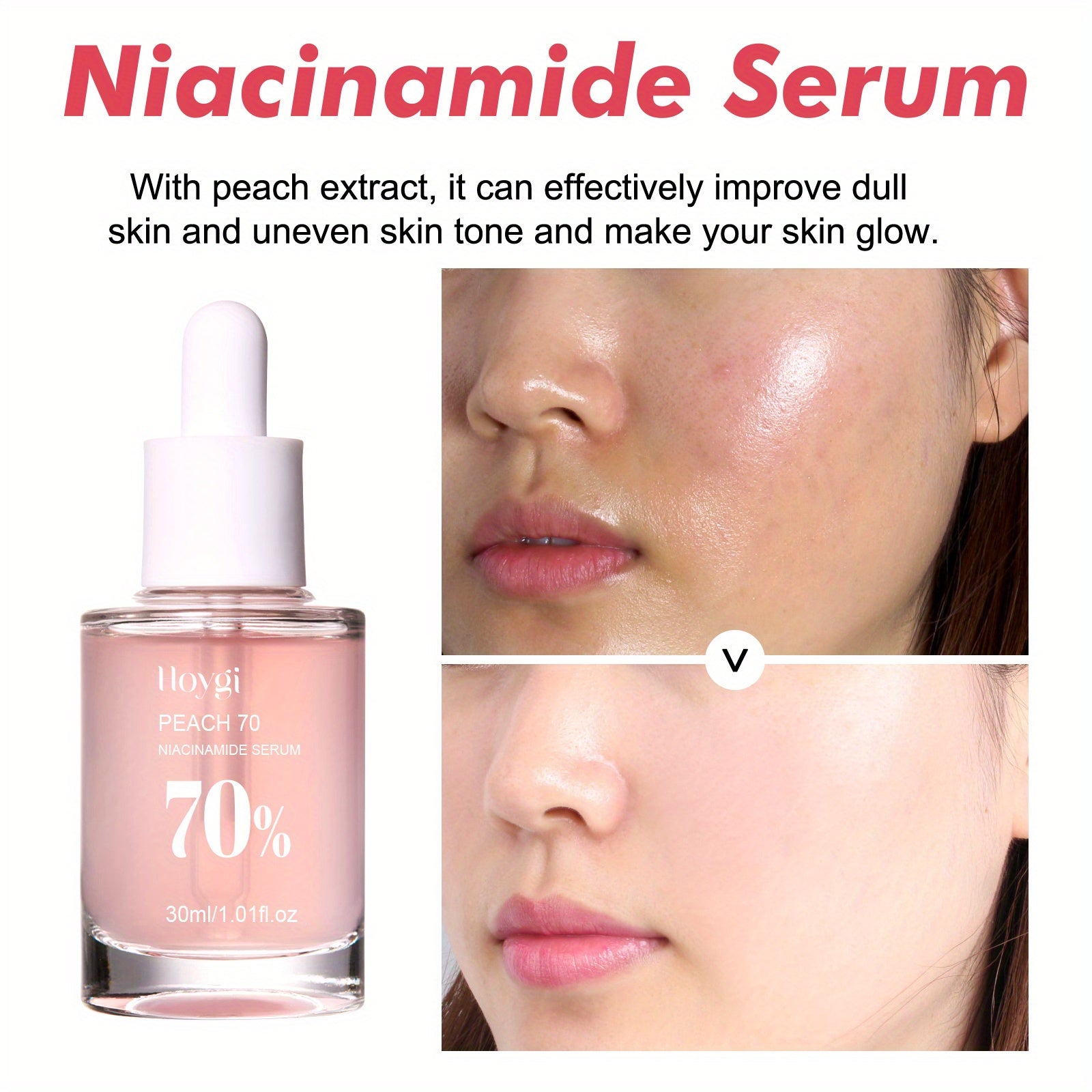 30ml Peach Glow Niacinamide Brightening Essence - Hydrates, Evens Skin Tone, and Plumps Fine Lines - With Peach Extract, Nicotinamide, and Glycerin, Daily Clean Beauty for Radiant Face