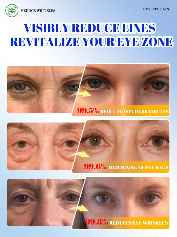 Care for your most charming part, starting from your eyes